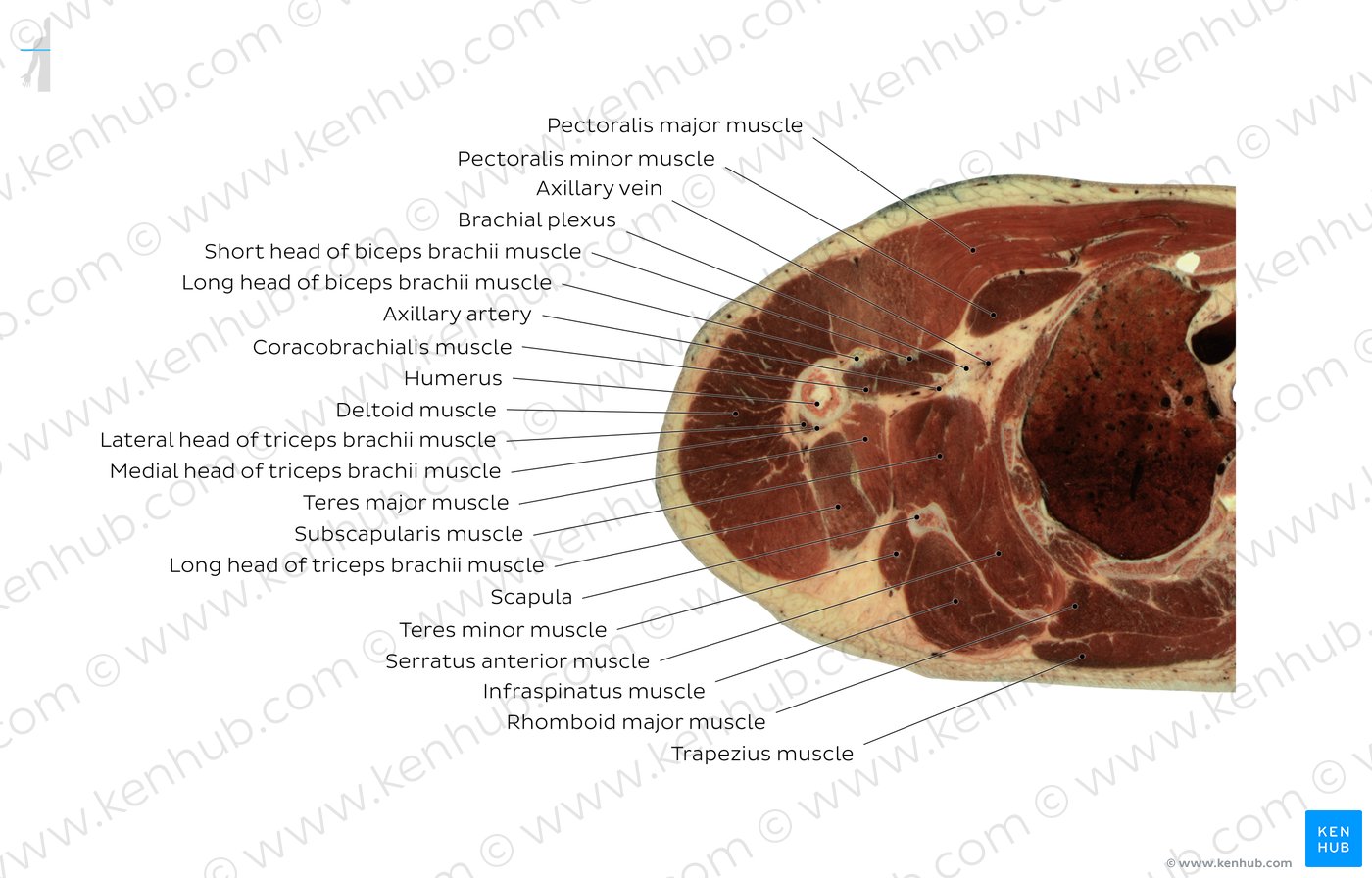 Coracobrachialis muscle level: Overview