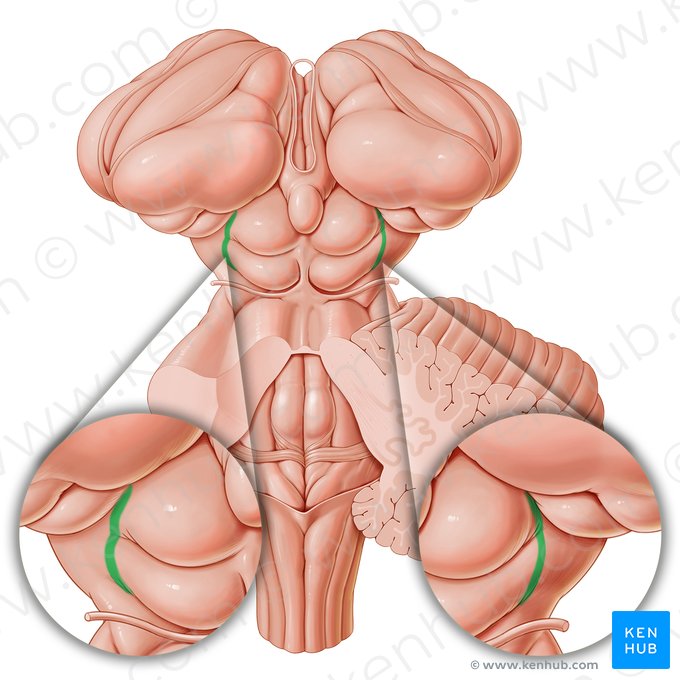 Sulco lateral do mesencéfalo (Sulcus lateralis mesencephali); Imagem: Paul Kim