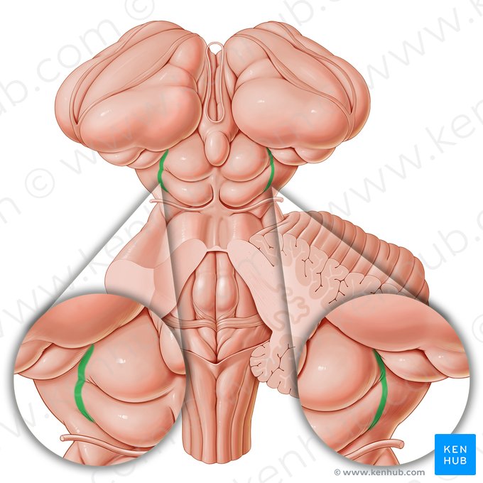 Lateral groove of midbrain (Sulcus lateralis mesencephali); Image: Paul Kim