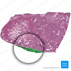Lobule of parathyroid gland (Lobulus glandulae parathyroidae); Image: 