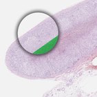 Zona reticular