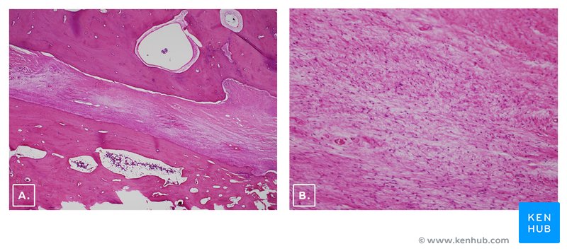 Histological Section of a Facial Nerve and Facial Canal