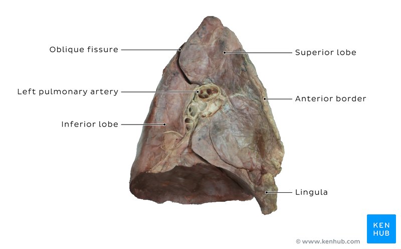 Mediastinal surface of the left lung -  cadaveric image