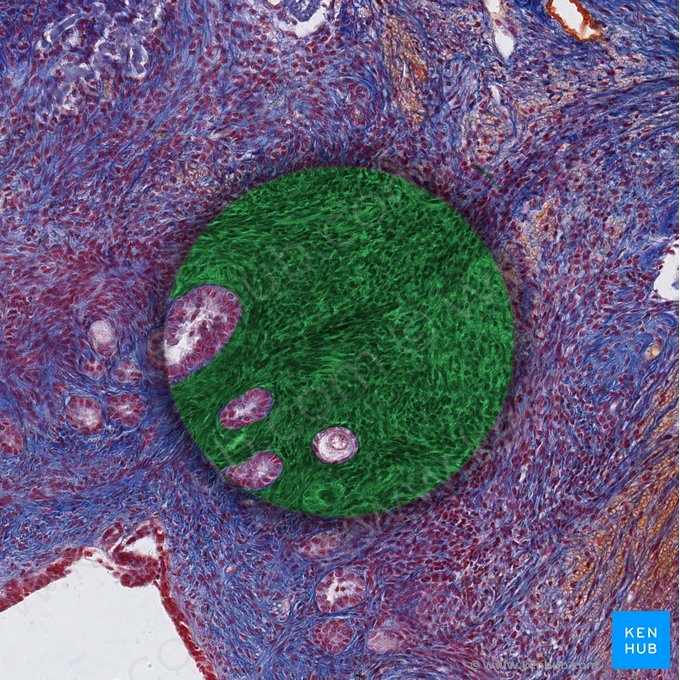 Tejido conectivo espinocelular; Imagen: 