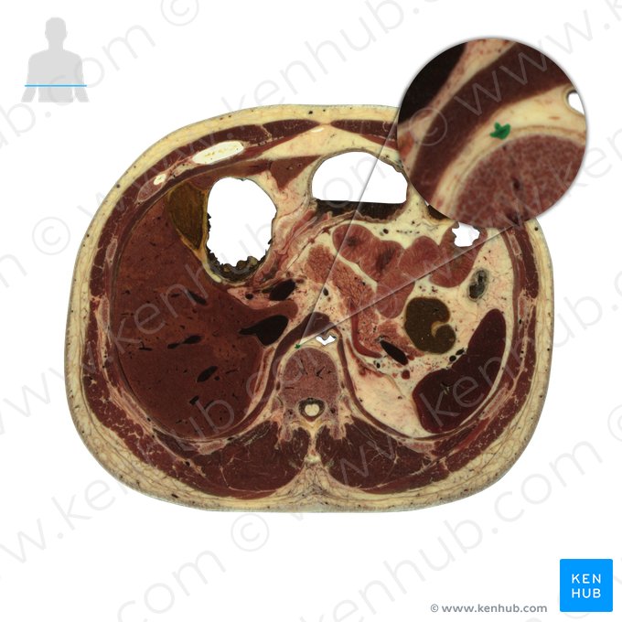 Azygos vein (Vena azygos); Image: National Library of Medicine