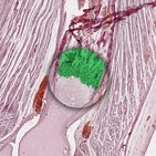 Endochondral ossification