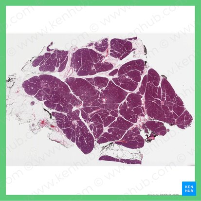 Cola del páncreas (Cauda pancreatis); Imagen: 