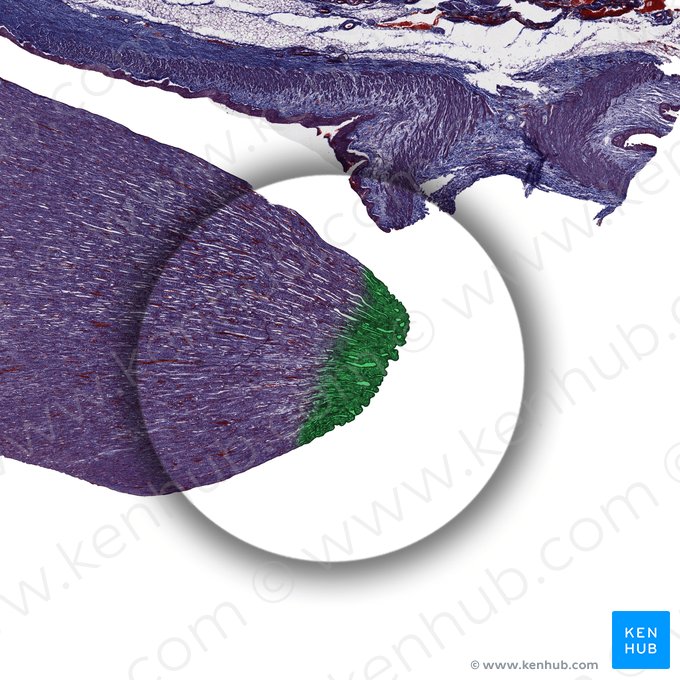 Area cribrosa papillae renalis (Siebfeld der Nierenpapille); Bild: 