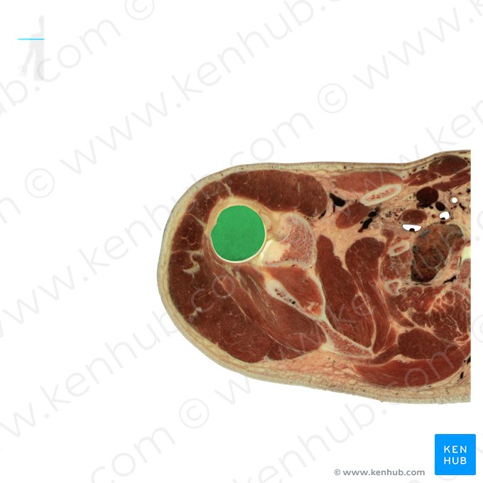 Úmero (Humerus); Imagem: National Library of Medicine