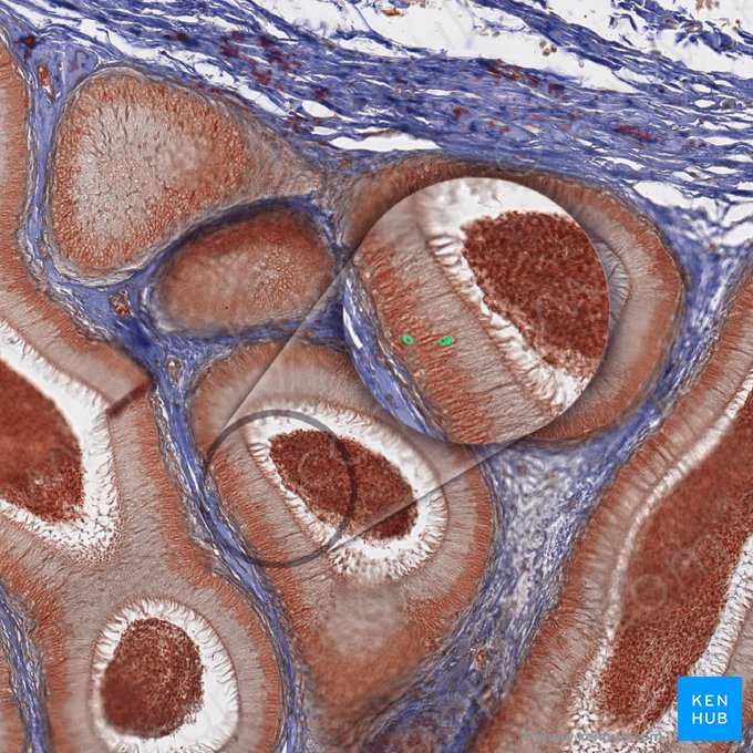 Halo cells; Image: 