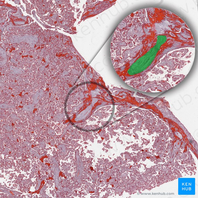 Stromal connective tissue; Image: 
