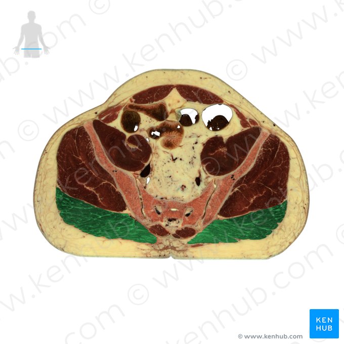 Músculo glúteo máximo (Musculus gluteus maximus); Imagem: National Library of Medicine