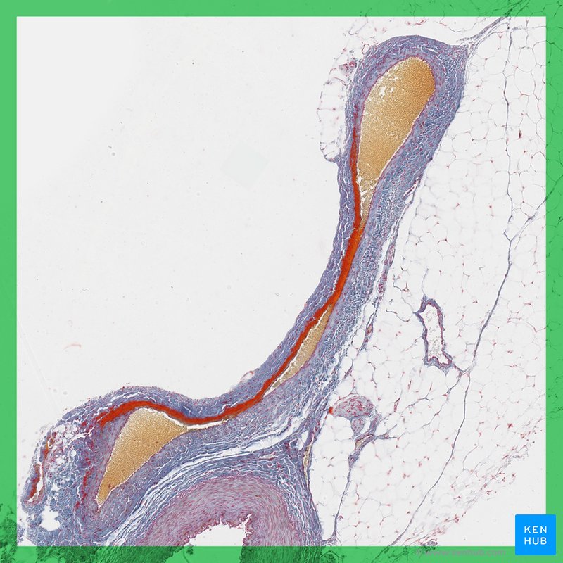 Medium vein - histological slide