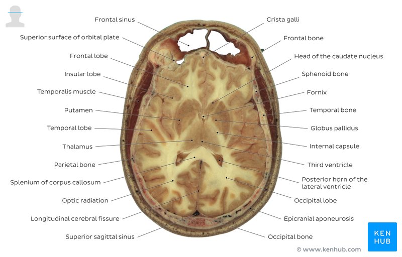 Brain cross section through the thalamus: Axial view