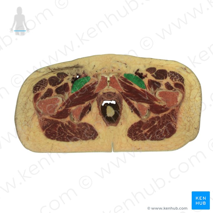 Musculus pectineus (Kammmuskel); Bild: National Library of Medicine