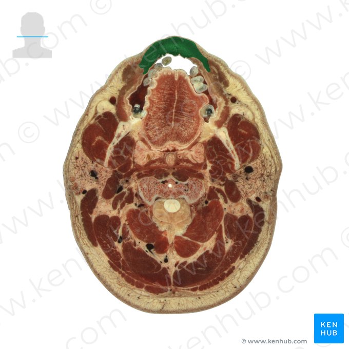 Músculo orbicular da boca (Musculus orbicularis oris); Imagem: National Library of Medicine