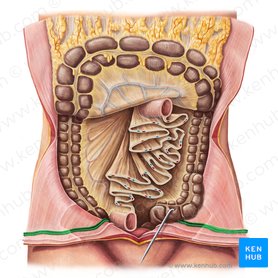 Abdominal wall: Layers, muscles and fascia | Kenhub