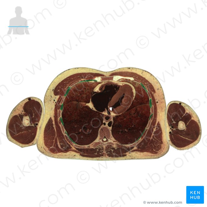 Musculi intercostales interni (Innere Zwischenrippenmuskeln); Bild: National Library of Medicine