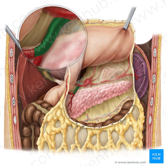 Arteria gastroduodenal (Arteria gastroduodenalis); Imagen: Esther Gollan