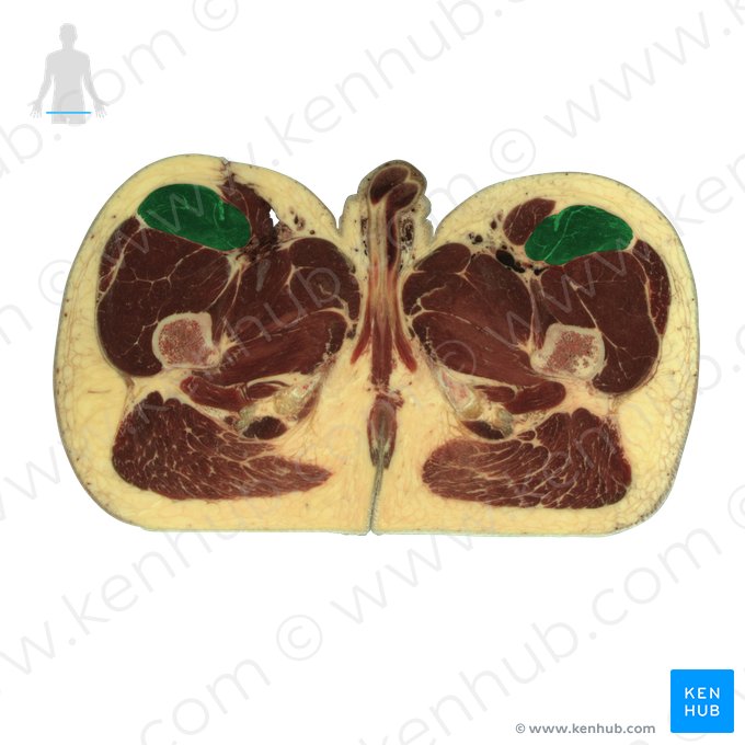 Rectus femoris muscle (Musculus rectus femoris); Image: National Library of Medicine