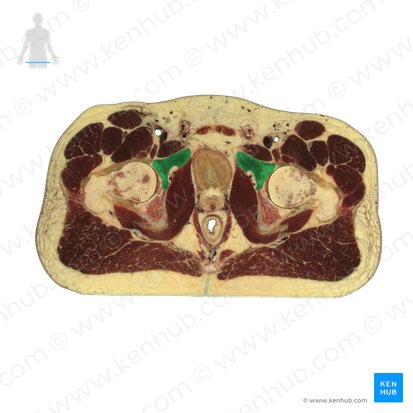 Púbis (Os pubis); Imagem: National Library of Medicine