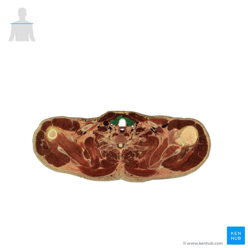 Thyroid gland - cross-sectional view