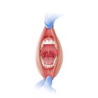 Aperçu de la cavité orale