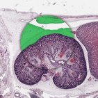 Brown adipose tissue 