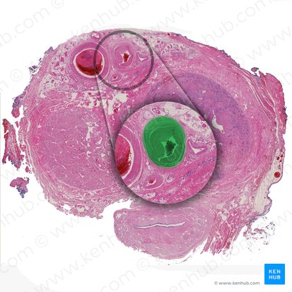 Arteria dorsal del pene (Arteria dorsalis penis); Imagen: 