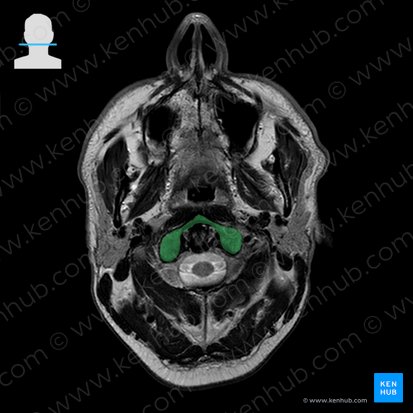 Atlas; Image : 