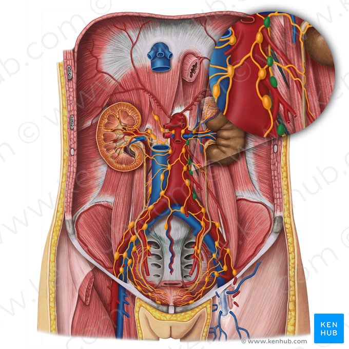Nodi lymphoidei aortici laterales (Seitliche Aortenlymphknoten); Bild: Irina Münstermann