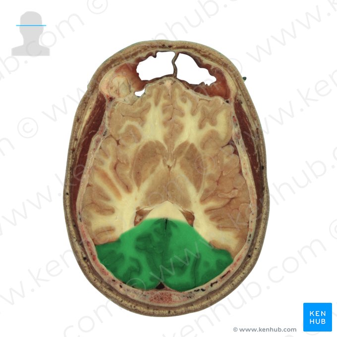 Lobus occipitalis (Hinterhauptlappen); Bild: National Library of Medicine