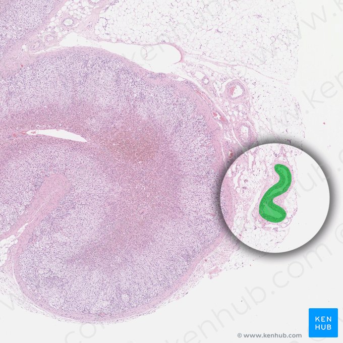 Suprarenal artery (Arteria suprarenalis); Image: 