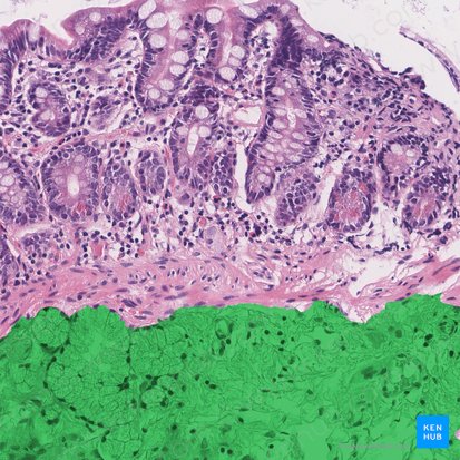 Submucosa (Tela submucosa); Imagen: 