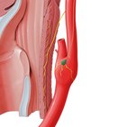 Carotid body