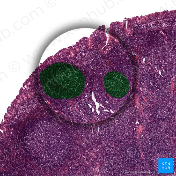 Ganglio linfático (Nodulus lymphoideus); Imagen: 