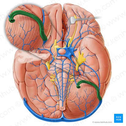 Sigmoid sinus (Sinus sigmoideus); Image: Paul Kim