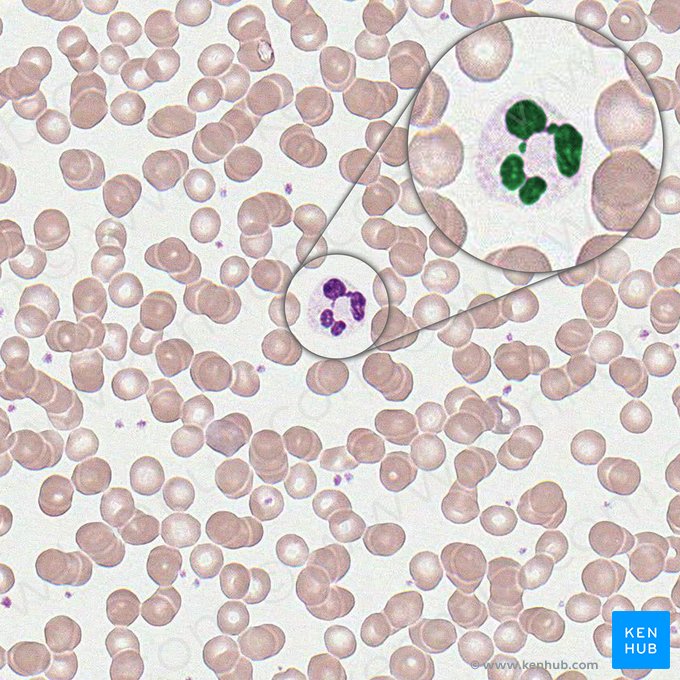 Multilobed nucleus of neutrophil (Nucleus multilobatus neutrophili); Image: 