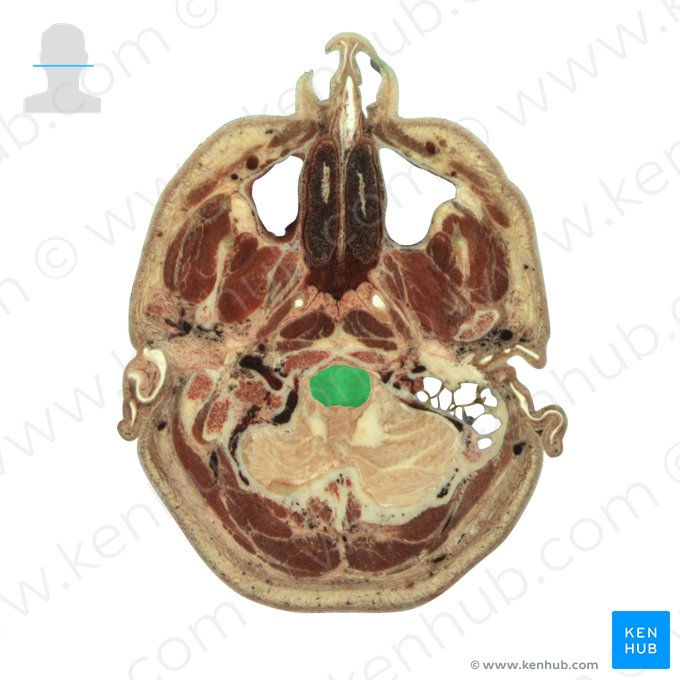 Medulla oblongata; Image: National Library of Medicine