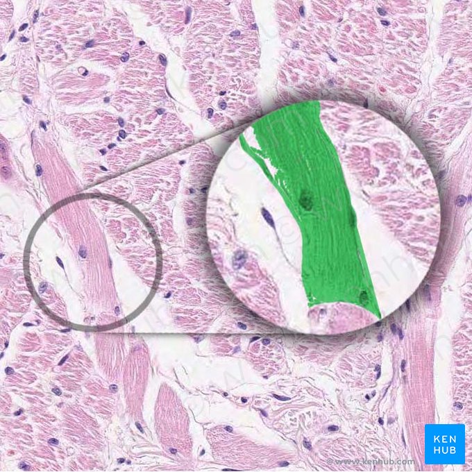 Miócito (Fibra muscular) (Myocytus (Myofibra)); Imagem: 