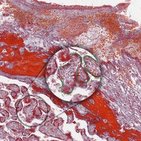 Synzytiotrophoblast