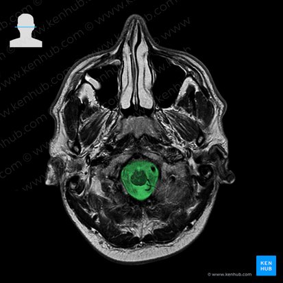 Foramen magno del hueso occipital (Foramen magnum); Imagen: 