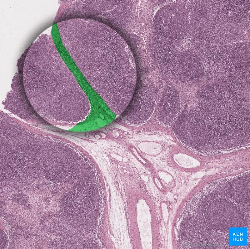 Trabeculae - histological slide