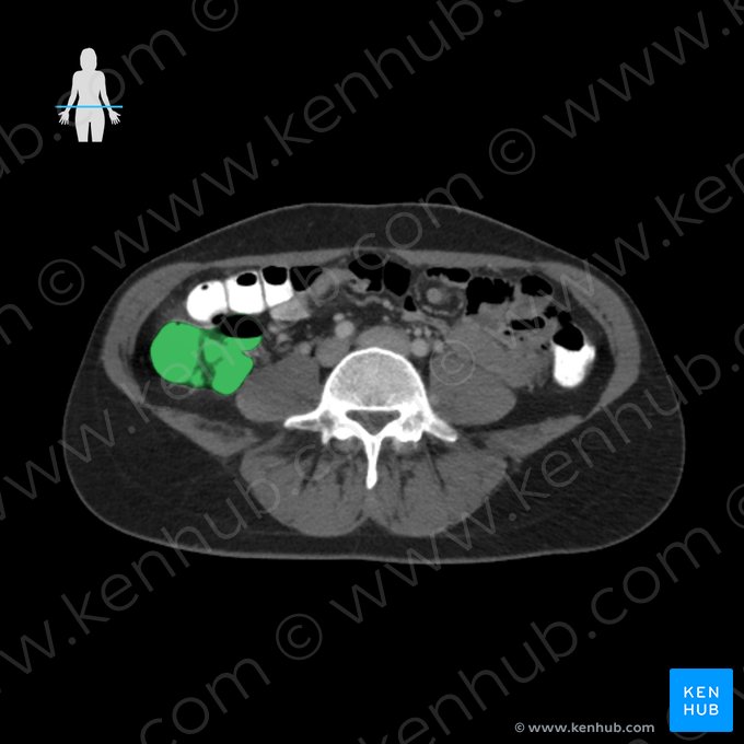 Colon ascendente (Colon ascendens); Imagen: 