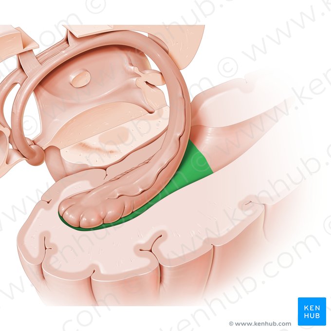 Temporal horn of lateral ventricle (Cornu temporale ventriculi lateralis); Image: Paul Kim