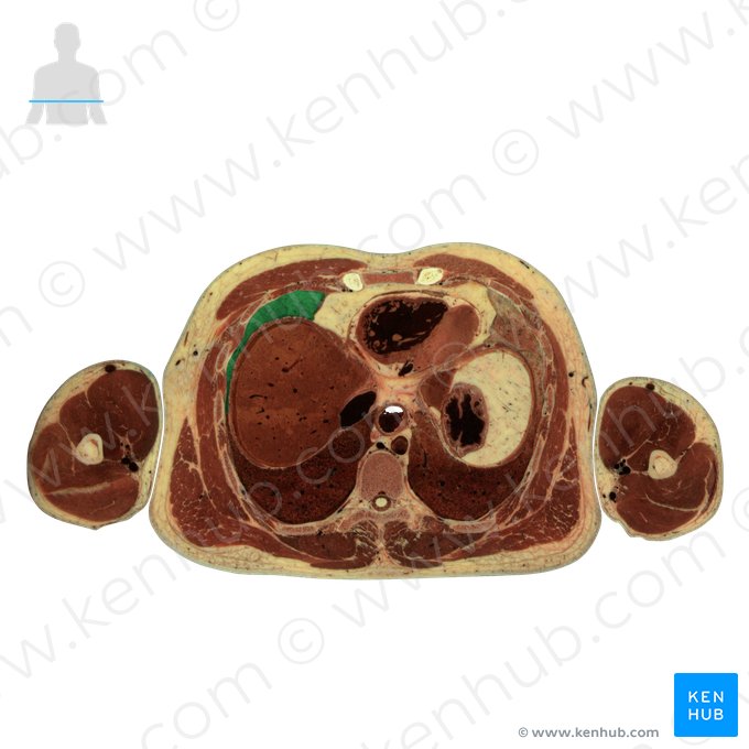 Middle lobe of right lung (Lobus medius pulmonis dextri); Image: National Library of Medicine