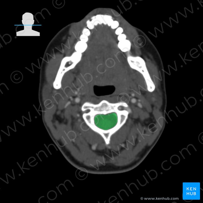 Conducto vertebral (Canalis vertebralis); Imagen: 