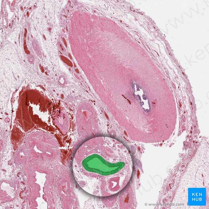 Arteria testicular (Arteria testicularis); Imagen: 