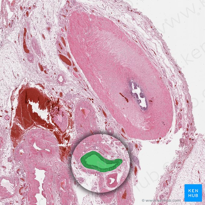 Arteria testicularis (Hodenarterie); Bild: 