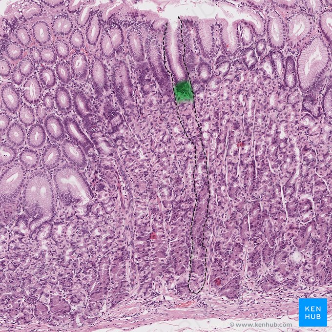 Itsmo de las glándulas gástricas (Isthmus glandulae gastricae); Imagen: 